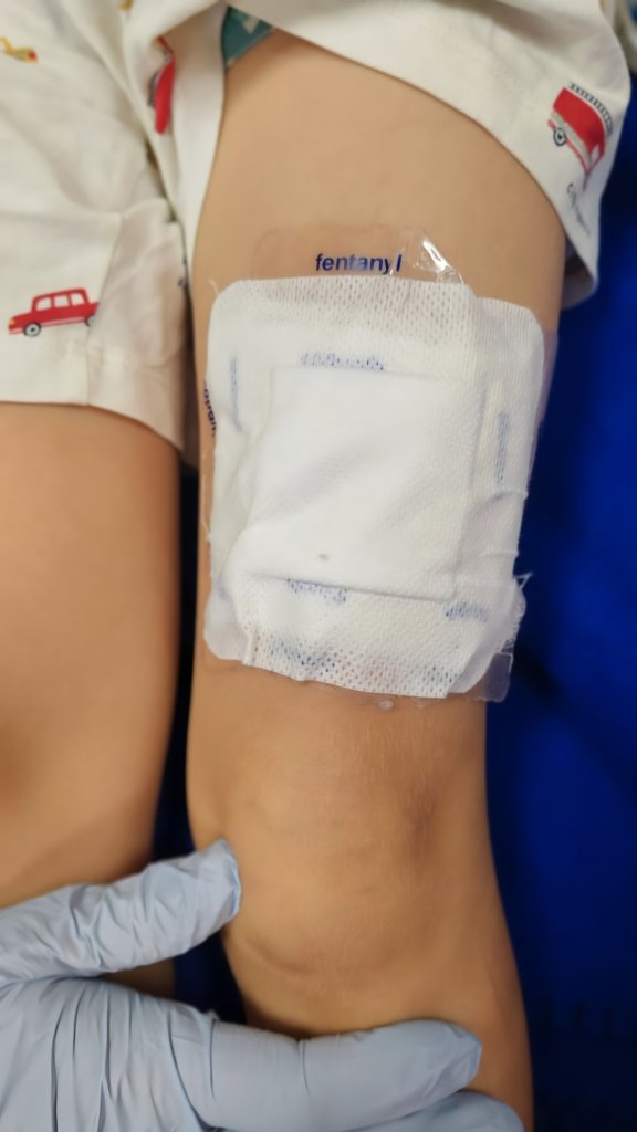 Copil de șase ani în comă după plasturi cu fentanyl puși de sora lui