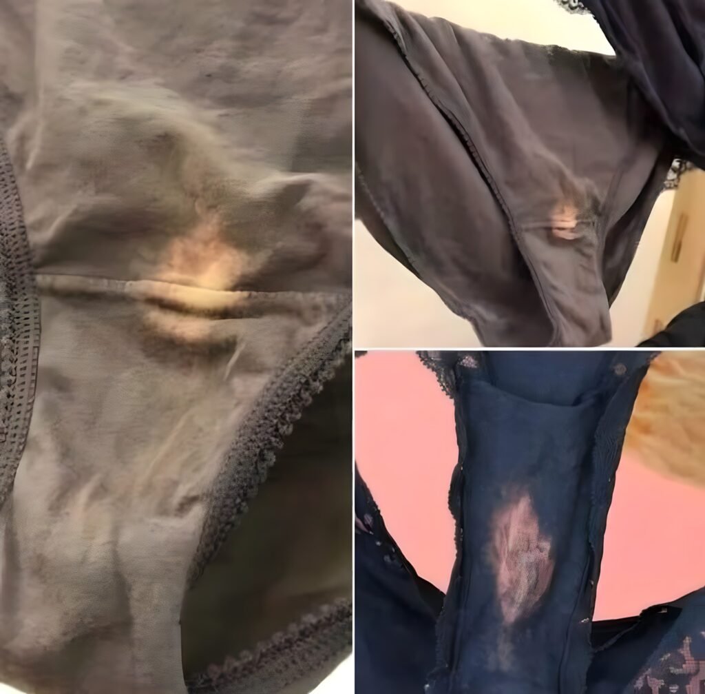 Dacă găsești o pată de „înălbitor” pe lenjeria ta intimă, iată ce înseamnă